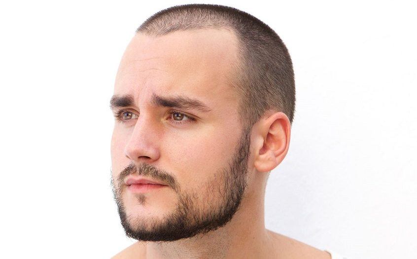 Rogaine for beard bald spots