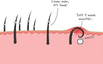 Ingrown Facial Hair: How to Prevent & Get Rid of It For Good