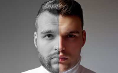 Beard Transplants: Pros, Cons, Cost, Results & More