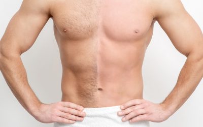 Chest Hair Removal: 9 Painless & Effective Methods