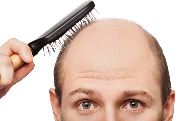 Most Popular Hairstyles for Balding Men - Side Part