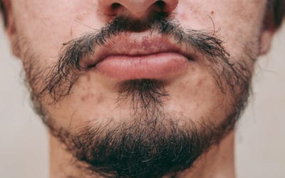 Patchy Mustache: How to Fix Thin Stache & Make It Thicker