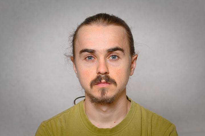 Worried Man With Goatee and Disconnected Mustache