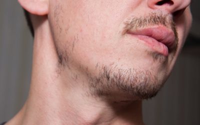 9 Clear Signs You Can’t Grow a Beard (Backed by Science)