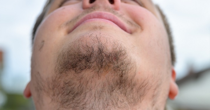 Wispy Beard With Patches