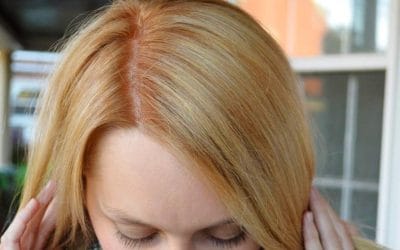 Hot Roots in Hair: 7 Effective Ways & Tips on How to Fix Them (Best Method & Instructions)