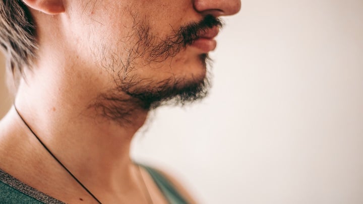 patchy-beard-that-looks-like-pubes